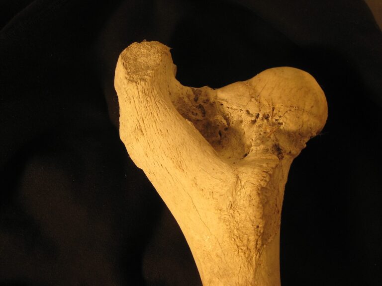 bone-health-image